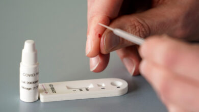 Kosovë/ Nga e hëna nis licencimi i laboratorëve privatë për realizimin e testeve serologjike Kosovë/ Nga e hëna nis licencimi i laboratorëve privatë për realizimin e testeve serologjike