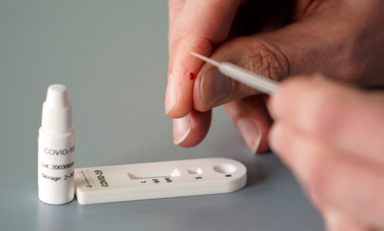 Kosovë/ Nga e hëna nis licencimi i laboratorëve privatë për realizimin e testeve serologjike Kosovë/ Nga e hëna nis licencimi i laboratorëve privatë për realizimin e testeve serologjike