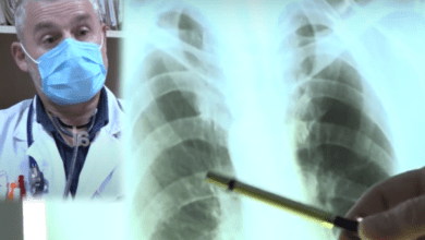Sa kushton mjekimi i Covid në kushte shtëpie, mjeku: Kur duhet të përdoret antibiotiku Sa kushton mjekimi i Covid në kushte shtëpie, mjeku: Kur duhet të përdoret antibiotiku