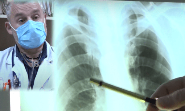 Sa kushton mjekimi i Covid në kushte shtëpie, mjeku: Kur duhet të përdoret antibiotiku Sa kushton mjekimi i Covid në kushte shtëpie, mjeku: Kur duhet të përdoret antibiotiku