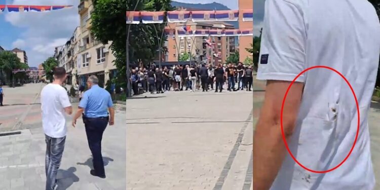 VIDEO/ Të “mbuluar” nga gjaku, Sulmohen dy shqiptarë në Mitrovicë, dërgohen të plagosur në spital VIDEO/ Të “mbuluar” nga gjaku, Sulmohen dy shqiptarë në Mitrovicë, dërgohen të plagosur në spital